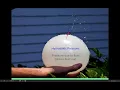 50 Introduction to oncotic pressure and hydrostatic pressure