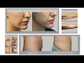 Revitalize Surgery and Spa The Perfect Choice
