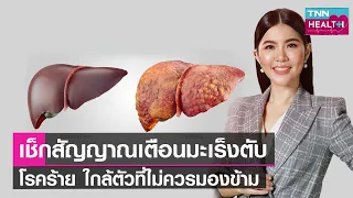  ใครมีความเสี่ยงสูงต่อการเป็นมะเร็งตับ และควรตรวจคัดกรองอย่างไร 