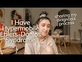 i was diagnosed w hypermobile ehlers-danlos syndrome how i was diagnosed with hEDS comorbidities