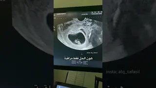 النزيف في بداية الحمل 