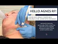 Non-Surgical Jowl Fat Removal