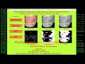 FingerNail Disease Detection Using CNN Python Project Source Code Final Year Projects