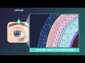 OPTASE DRY EYE INTENSE DROPS - Advanced Lubrication for better patient outcomes