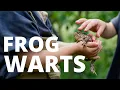 Warts Can Touching a Frog Toad or Their Pee Give You Warts