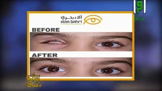 الدكتورة الاء بحري أخصائية صناعة وتركيب العيون الصناعية دندنها