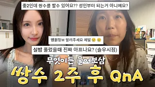 드디어 2주 만에 쌍수 한 눈 공개합니다! 무엇이든 물어보세요 Q&A 편 (실제 후기 포함)
