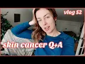 Answering Questions About My Skin Cancer Diagnosis Vlog