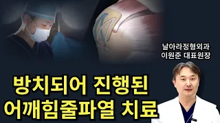 방치되어 진행된 어깨 회전근개파열 치료사례