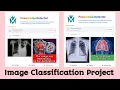 Pneumonia Detector Image Classification Using CNN Deep Learning Project Tensorflow Keras