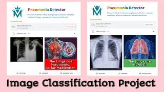Pneumonia Detector Image Classification Using CNN Deep Learning Project Tensorflow Keras
