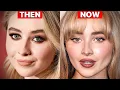 Sabrina Carpenter s NEW Face Plastic Surgery Analysis