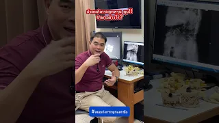  กระดูกพุนยุบเกิดจากสาเหตุอะไร และมีผลกระทบอย่างไรต่อร่างกาย 