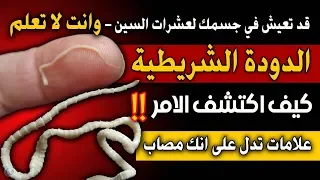 الدودة الشريطية علامات تدل على انها تعيش في جسدك  كيف اكتشف الامر    سبل العلاج والوقاية منها دندنها