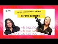 Pre-Surgery Checklist What to Expect Before Plastic Surgery From Two Female Plastic Surgeons
