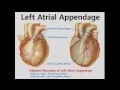 Cardiac Anatomy and Electric Mapping for Ablation of Atrial Fibrillation