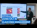 How to use OCT for glaucoma management