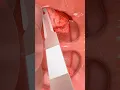 Download Lagu Tonsillectomy explained (3D Animation)