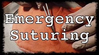 How to Suture for Emergencies | Sailing Wisdom
