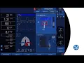 How to shift the PetCO2 target range in INTELLiVENT-ASV