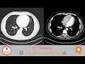 CT Thorax - Systematic Image Analysis