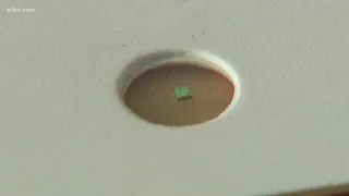 Digital pill tracks medication inside stomach