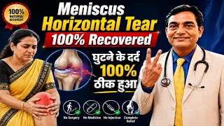 Horizontal Meniscus Tear 100% Recovery घुटने का दर्द 100% ठीक हुआ #meniscustear #ghutnekadard 
