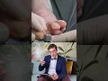 Download Lagu Couper un ongle incarné sans douleur avec la turbine