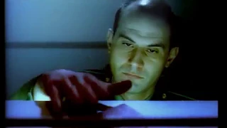 А тебе лысый я телефон не скажу Реклама 90 х 2000х смотрите рекламу пересадки волос 