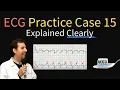 ECG EKG Practice Case 15 - Step by Step Interpretation