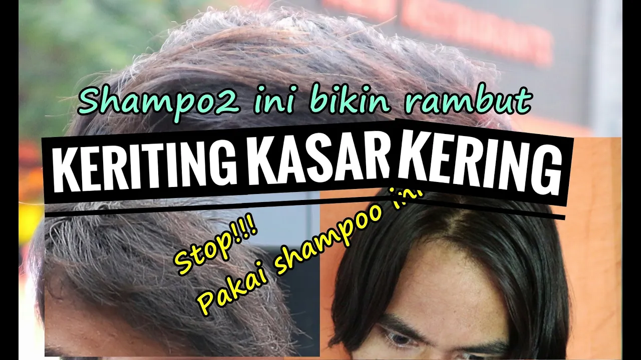 Cara Mengatasi Rambut Rontok Secara Ampuh || Desty Yufenti hai semuanyaaa.... kalian punya masalah r. 
