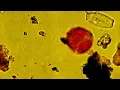 Bad allergies Here s how Houston health s track pollen and allergy issues in our community