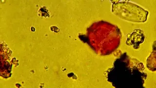 Bad allergies Here s how Houston health s track pollen and allergy issues in our community