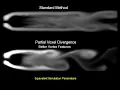 Cartesian Grid Fluid Simulation with Irregular Boundary Voxels