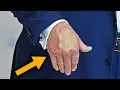 Download Lagu Sickly, swollen Trump looks EXTREMELY UNWELL