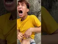 Download Lagu It's just an injection. Don't be afraid 😲👍| Kem Family Shorts #shorts