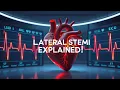 Lateral STEMI Made Easy ECG Leads Diagnosis Emergency Management Explained