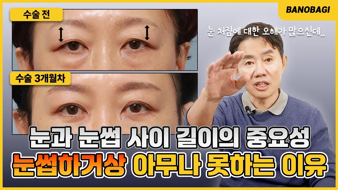 눈꺼풀 처짐, 진짜 원인은 눈이 아니라 이마다?!🔥 이마거상 or 눈썹하거상 구분 방법💛