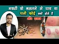 मकरी के मसलने से घाव-पानी फोड़े का इलाज | Spider infection treatment in Hindi | Kumars ayurvedic Gyan