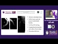 AMS2026 DAY1 HALL B 7 Imaging Paediatric Metabolic Bone Disorders Patterns Pitfalls and Pearls
