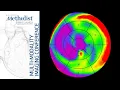 Download Lagu CMR and CT Assessment of LV Function and Hemodynamics (S. Chang MD, M. Malahfji MD) October 26, 2021