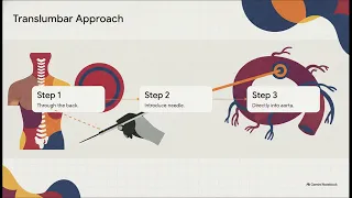 CPT Code 36160 EXPLAINED Translumbar Aortography Coding Made Simple