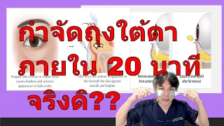 วิธีธรรมชาติที่ช่วยลดถุงใต้ตาได้จริงไหม และใช้เวลาเท่าไร