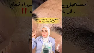 من غير الـ٤ خطوات دي الرؤوس السوداء مستحيل تروح الجزء التاني 