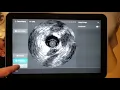 IntraSight is Seamless