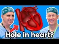 PFO Patent Foramen Ovale 1 in 4 People Have This What Every Patient Needs to Know