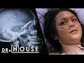 Sus padres insertaron ALFILERES EN SU CEREBRO al nacer Dr House Diagnostico Medico