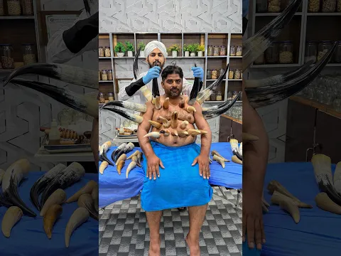 Horn Cupping Therapy for Shoulder, Arm & Belly Pain | Natural Traditional Cupping Therapy | Dr Usman