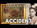 The Painful Accident Of 1925 That Changed Frida Kahlo Forever CH 4