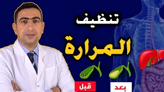 علاج المرارة بدون عملية متي يجب استئصال المراره جراحيا علاج حصوات المرارة بدون ادوية 